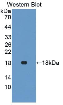 IFN Gamma / Interferon Gamma Antibody (aa22-186)