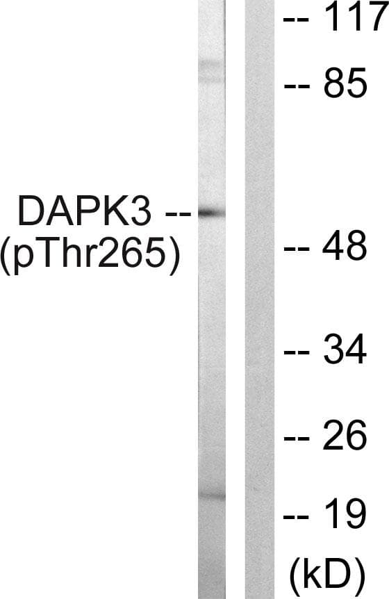 DAPK3 / ZIP Kinase Antibody (phospho-Thr265)