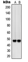 Polyclonal Rabbit anti-Human SIRPB1 / CD172b Antibody (Internal, WB)