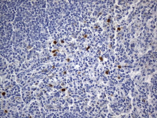 CD30 Antibody (aa408-595, clone UMAB256, Carrier-free)