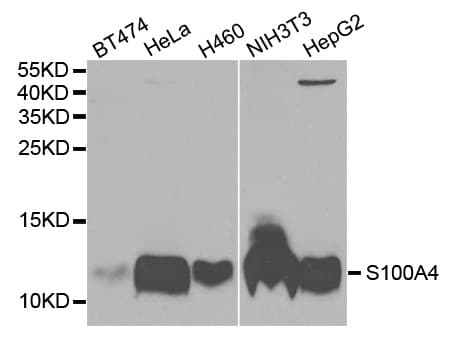 S100A4 / FSP1 Antibody