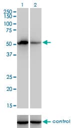 F9 / Factor IX Antibody (clone 2C9)