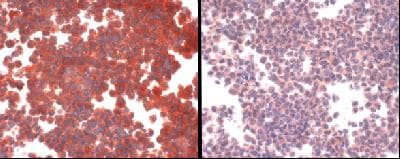SLC31A1 / CTR1 Antibody (C-Terminus)