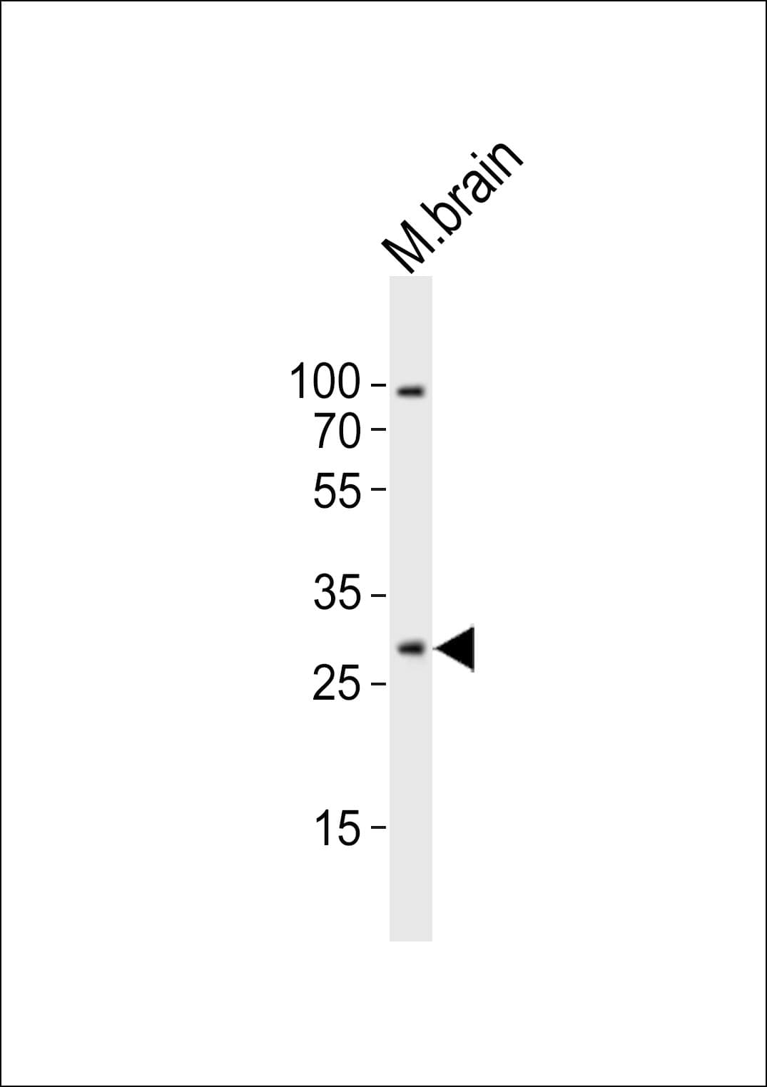 OLIG1 Antibody (aa161-184)