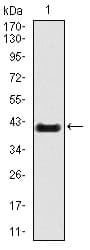 TBXT / T / Brachyury Antibody (clone 6C12)