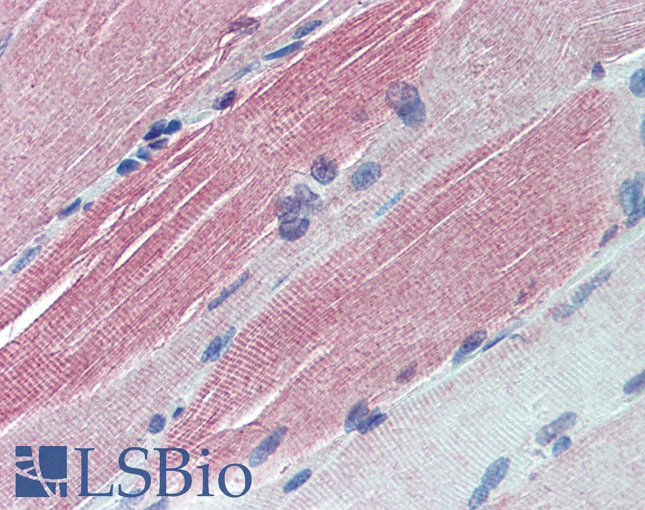 IHC-plus™ IGFBP6 Antibody (aa128-141)