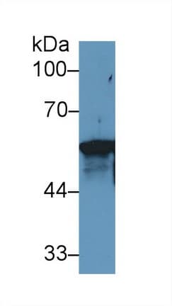 KRT6A / CK6A / Cytokeratin 6A Antibody (aa323-461)