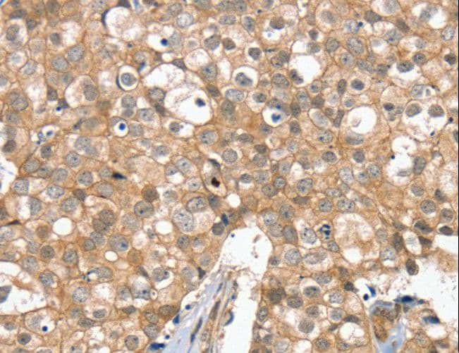 SLC6A7 Antibody