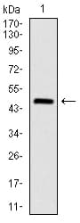 IHC-plus™ ASS1 / ASS Antibody (clone 2B10)