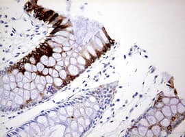 KRT20 / CK20 / Cytokeratin 20 Antibody (clone OTI2H9)