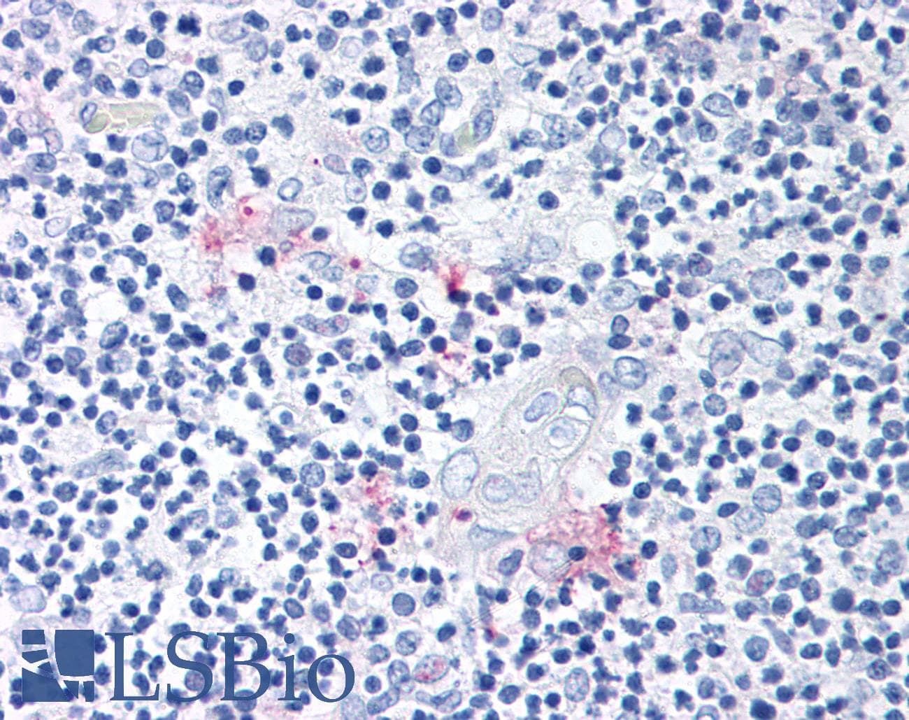 IHC-plus™ Polyclonal Rabbit anti-Human RORC / ROR Gamma Antibody (Modulating Domain, IHC)