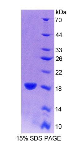 Bovine IFN Gamma / Interferon Gamma Protein (Recombinant His)