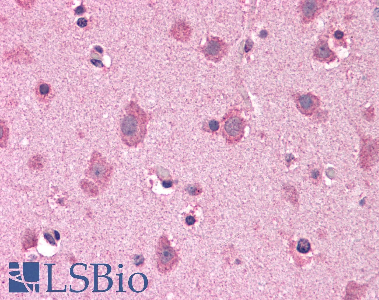 IHC-plus™ COPS8 / COP9 Antibody
