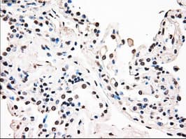 BRAF / B-Raf Antibody (clone OTI5A9)
