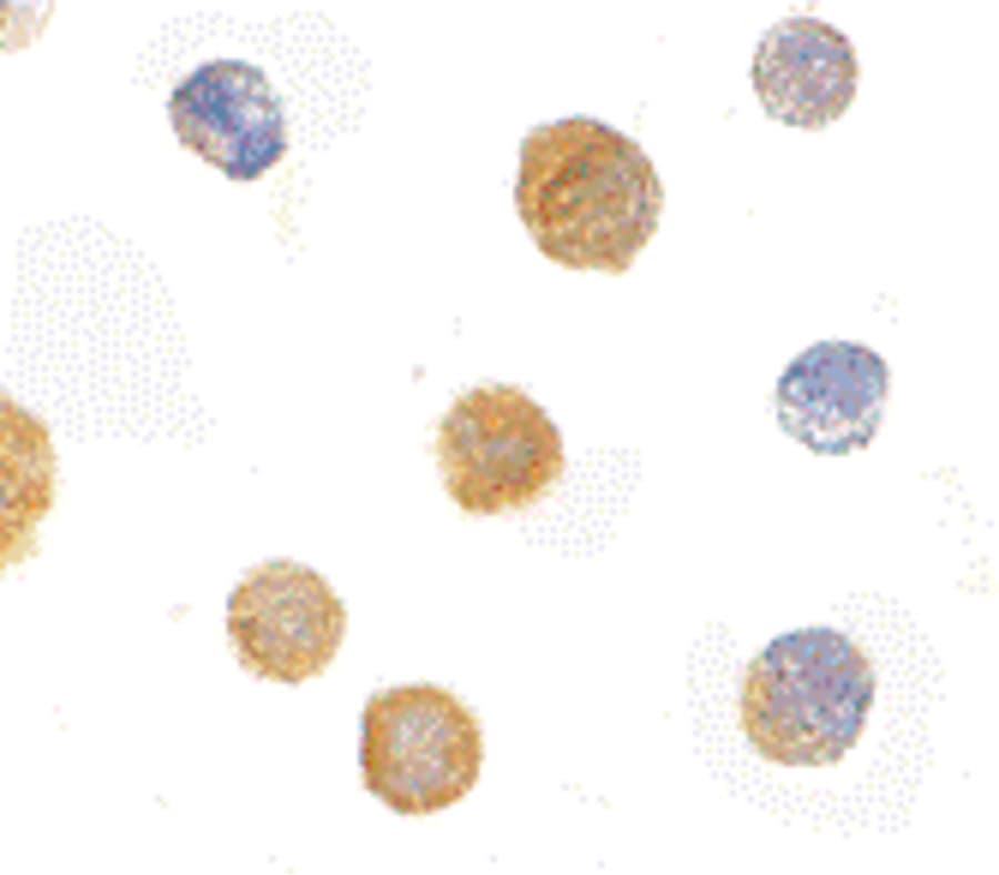 Polyclonal Rabbit anti-Human ADAP / FYB Antibody (IF, WB)