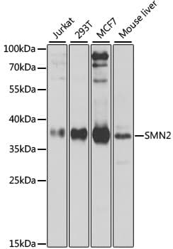 Polyclonal Rabbit anti-Human SMN2 Antibody (IHC, IF, WB)