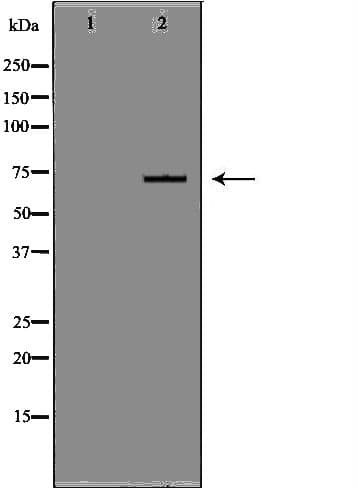 CD105 Antibody