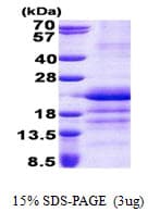 Human GATC Protein (Recombinant His)