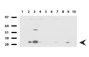 Adiponectin Antibody (aa19-244, clone UMAB104)