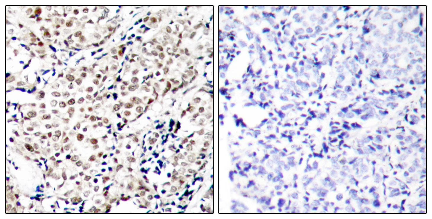 Polyclonal Rabbit anti-Human CHEK1 / CHK1 Antibody (phospho-Ser345, IHC)