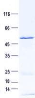 Human MTCH2 Protein (Recombinant GST, N-terminus + His, C-terminus)