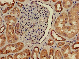 IHC-plus™ IL-22BP / IL22RA2 Antibody