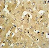 CRHR2 / CRF2 Receptor Antibody (aa243-272)