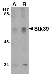 IHC-plus™ STK39 / SPAK Antibody