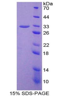 Human NUP37 Protein (Recombinant His-T7)