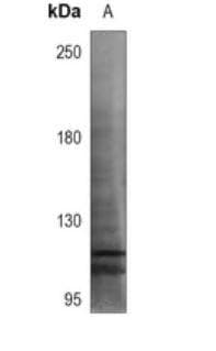 Polyclonal Rabbit anti-Human TTF1 / Txn Termination Factor Antibody (N-Terminus, IHC, WB)