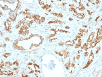 Monoclonal Mouse anti-Human AURKB / Aurora-B Antibody (clone AURKB/1593, IHC)