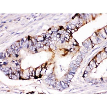 Polyclonal Rabbit anti-Human ZP2 Antibody (aa511-544, IHC, WB)