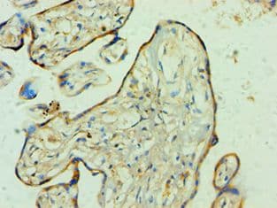 YWHAQ / 14-3-3 Theta Antibody (aa1-245)