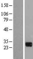 CTDSP1 / SCP1 Protein (Over-Expression Lysate Myc-DDK (Flag))