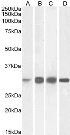 IHC-plus™ Polyclonal Goat anti-Human KHK / Ketohexokinase Antibody (IHC, WB)
