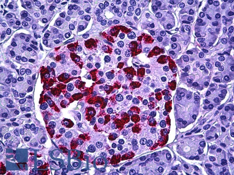 IHC-plus™ HRS / HGS Antibody (aa451-500)