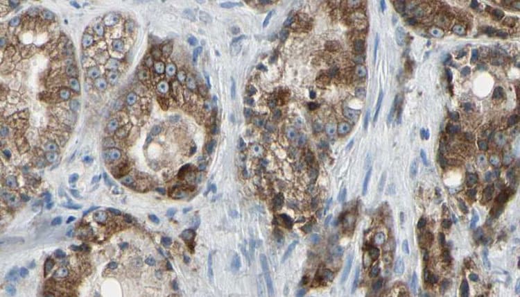 GOLGA2 / GM130 Antibody