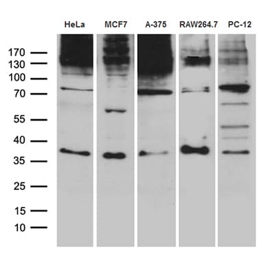 RNF4 Antibody (aa1-190, clone OTI9F10)