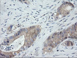 CATIP / C2orf62 Antibody (clone OTI4B4)