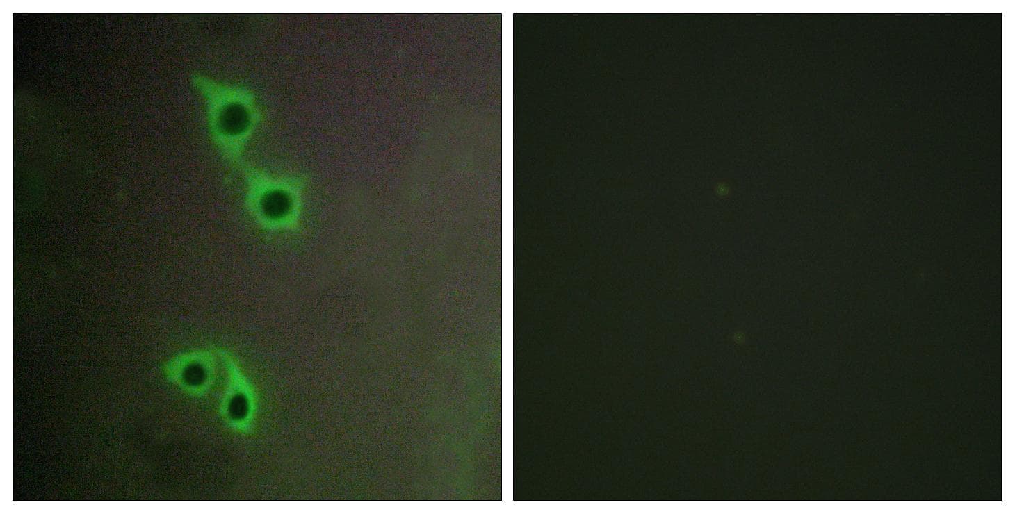 MAST4 Antibody