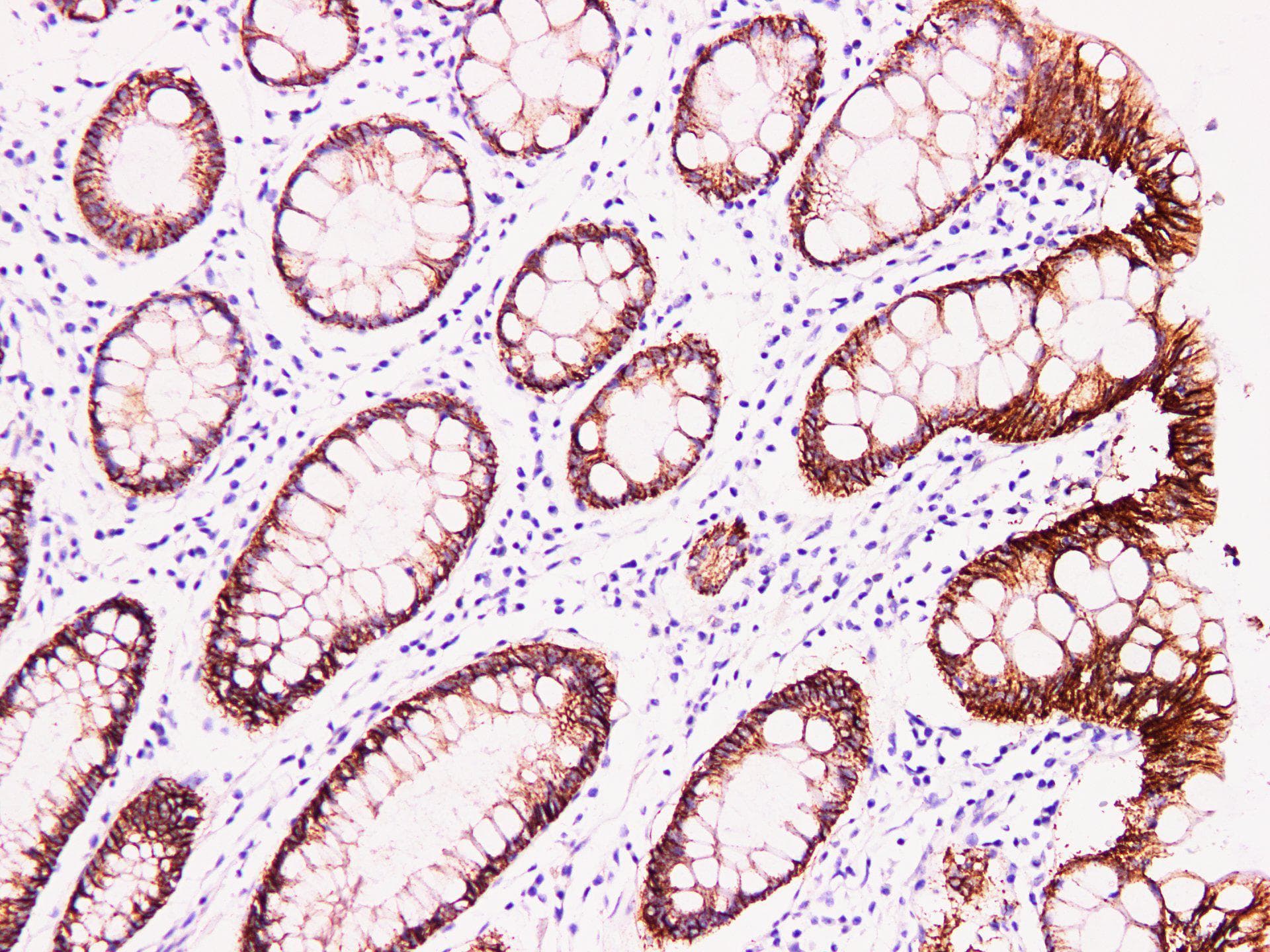 CLDN4 / Claudin 4 Antibody