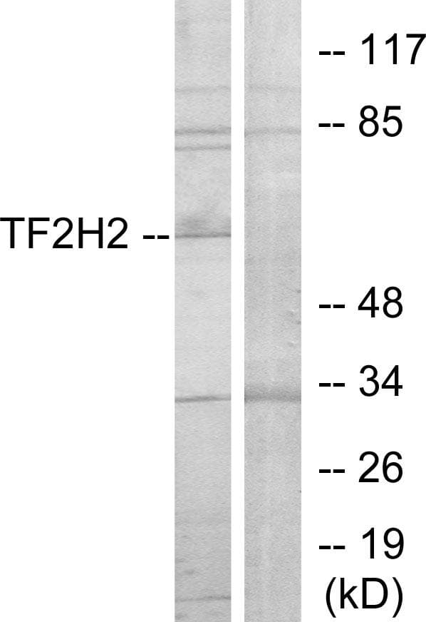GTF2H2 Antibody