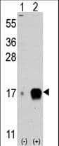 Fragilis / IFITM3 Antibody (aa64-93)