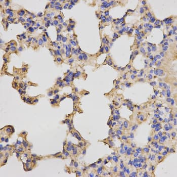 Polyclonal Rabbit anti-Human PRKACB Antibody (IHC, IF, WB)