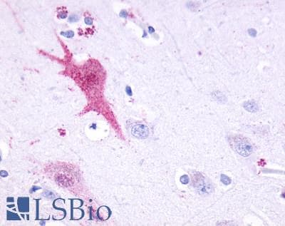 PathPlus™ Polyclonal Rabbit anti-Human ADGRF1 / GPR110 Antibody (N-Terminus, IHC)