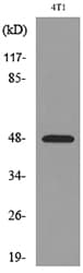 Alpha-1-Antichymotrypsin Antibody