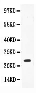 IL18 Antibody (aa37-193)