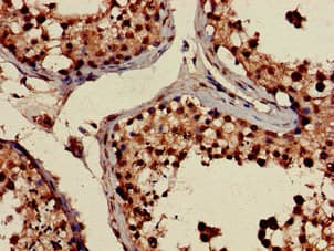 Polyclonal Rabbit anti-Human PRPS2 Antibody (IHC, IF, WB)