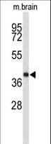 Polyclonal Rabbit anti-Human EN2 Antibody (aa243-271, IF, WB)