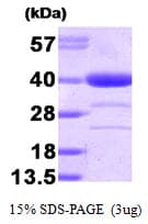 Human AKR1A1 Protein (Recombinant)